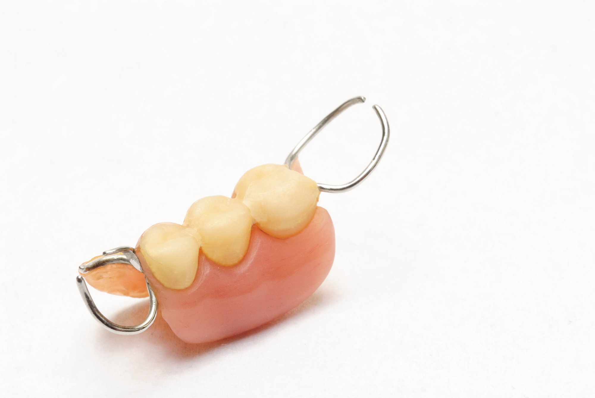 入れ歯治療の種類