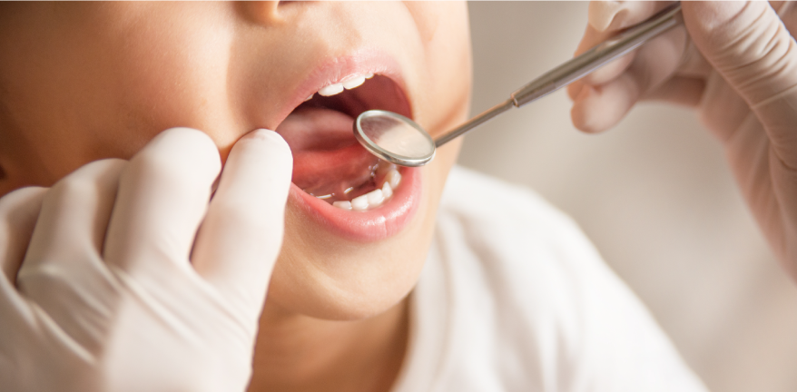 小児の予防ケア